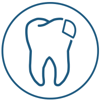 Icon Zahn Füllungen